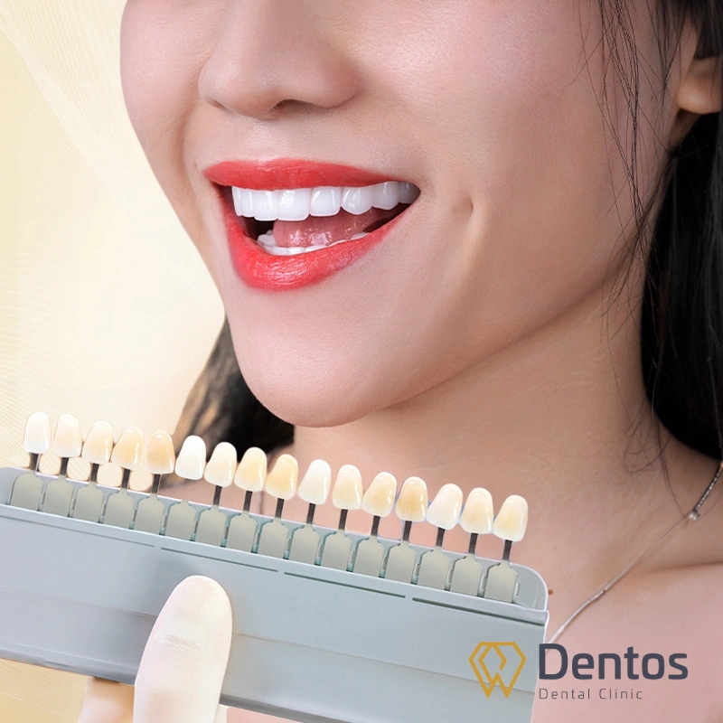 Đa dạng màu sắc tự nhiên khi lựa chọn bọc răng sứ